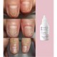 Масло при повреждении ногтевой пластины Shelly - Стоп Онихолизис - Stop Nail Delamination, 30 мл
