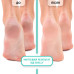 Пінний експрес-розм'якшувач для педикюру Shelly - Foot Callus Softening Foam, 150 мл